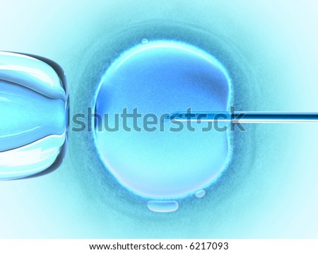 In vitro fecundation using sperm (also called in vitro fertilization).