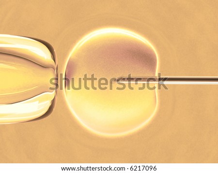 In vitro fecundation using sperm (also called in vitro fertilization).
