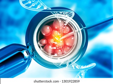 In vitro fertilisation, IVF. 3d illustration 	
