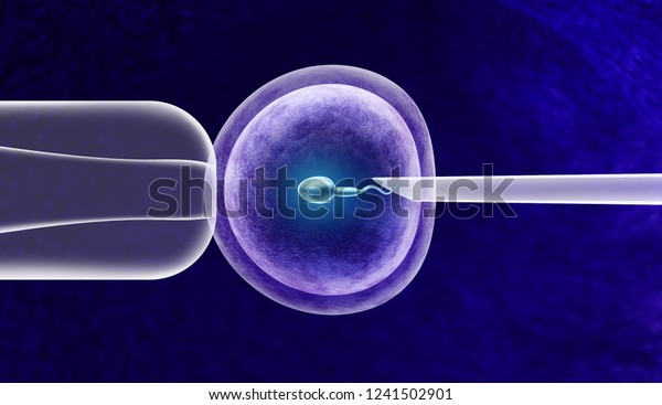 Vitro Fertilization Ivf Fertility Treatment Artificial Stock Illustration 1241502901 