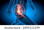 Walking man with painful hip joint with blue background- x-ray illustration