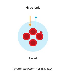 Water Diffuses Into Red Blood Cell By Plasma Membrane Pathway, Hypotonic Solution As Lysed Condition The Water Balance Concept In Animal Cells.