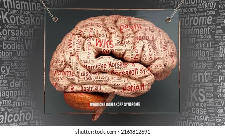 Wernicke Korsakoff Syndrome Human Brain Dozens Stock Illustration ...