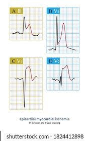 158 St segment elevation Images, Stock Photos & Vectors | Shutterstock