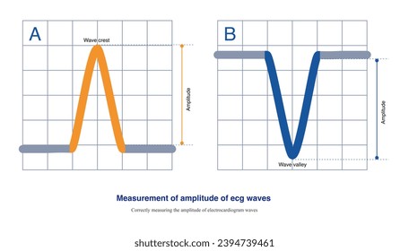 When the polarity of the ECG wave is different, there are two methods for measuring the amplitude, both of which measure from a certain edge of the baseline to the vertex of the ECG wave.