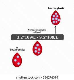 215 Leukocytosis Images, Stock Photos & Vectors | Shutterstock