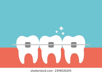 White teeth with dental braces. Alignment of bite of teeth. Dental clinic service, cosmetic odontology, teeth straightening, and orthodontic procedures concept. - Powered by Shutterstock