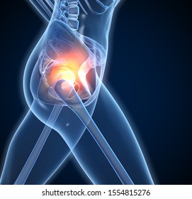 Woman with arthritic hip joints and skeleton, medically 3D illustration on blue background