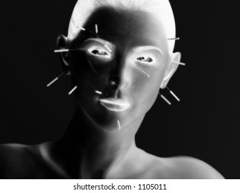 woman having acupuncture