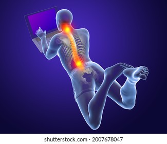 Working with laptop in a wrong position. Concept of backache, back pain. 3D illustration showing male body with highlighted skeleton working in a wrong position