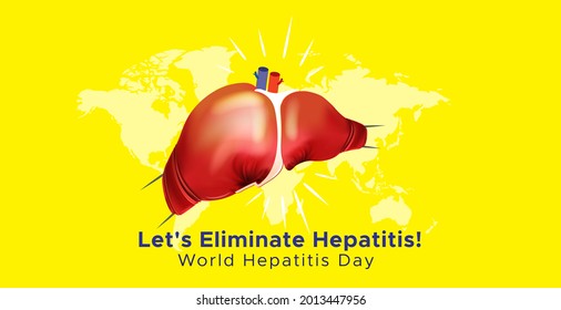 World hepatitis day concept creative and idea - Powered by Shutterstock