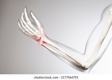 Wrist joint pain, arm and bone 3d illustration - Powered by Shutterstock