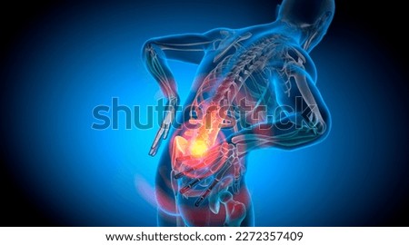 X Ray 3D Rendering - Man with severe pain in the spine and intervertebral discs - Herniated disc -3D illustration Stockfoto © 