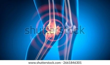 X ray illustration of a walking man with pain in knee joint with blue background - 3D illustration