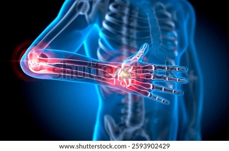 X ray style 3D Rendering - Severe pain in the joints - Rheumatism and arthrosis - 3D illustration