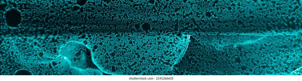 Xray Background. Micro Human Bone Scan. Black Microscopy Pattern. Modern Artwork With Mist Effect. Blue Biotechnology Fluid. Molecular Splash. Turquoise Xray Background.