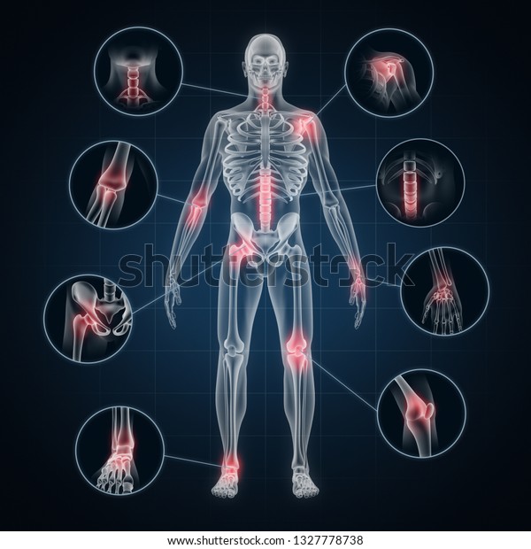 Xray Full Body Human Skeleton Osteoarthritis Stock Illustration 1327778738