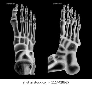 Xray Human Foot Bone Anterior View Stock Illustration 1114428629 ...