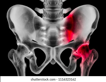 X-ray of human pelvis anterior view red highlight in sacroiliac joint and hip socket in right side pain area- 3D medical and Biomedical illustration- Human Anatomy and Medical Concept-Black background