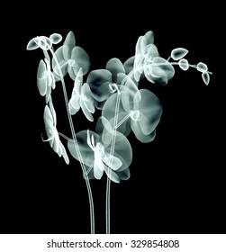 Xray Image Of A Flower  Isolated On Black , The Orchid