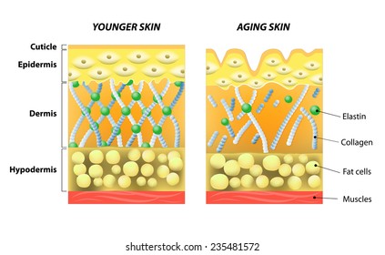 Younger Skin And Aging Skin. Elastin And Collagen. A Diagram Of Younger Skin And Aging Skin Showing The Decrease In Collagen And Broken Elastin In Older Skin.