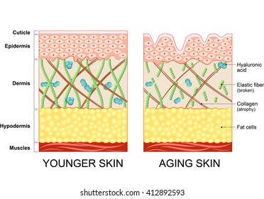 Younger Skin And Aging Skin. Elastin And Collagen.