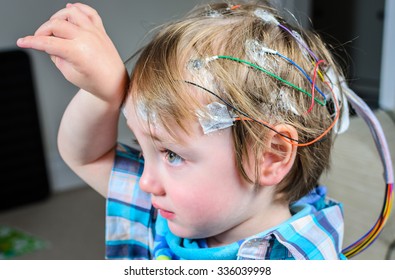A 2 Year Old Boy With 24hr EEG Electrodes Attached To His Head
