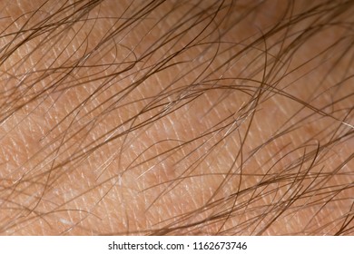 A 2x Macro Close Up Of The Hair And Skin Of A Man's Forearm 