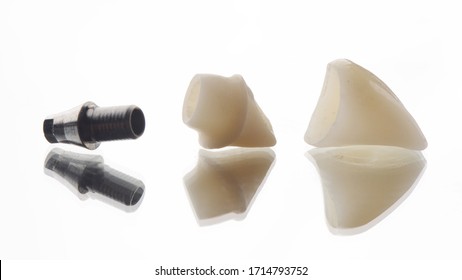 3 piece of restoration on dental implant consist of titanium abutment, Zirconia coping and Emax crown, Screw retained prosthesis on front teeth dental implant.