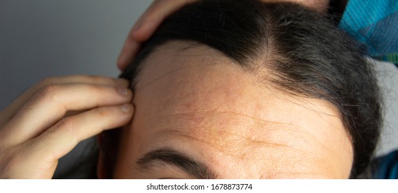 30 Year Old Young Man Receding Stock Photo 1678873774 | Shutterstock