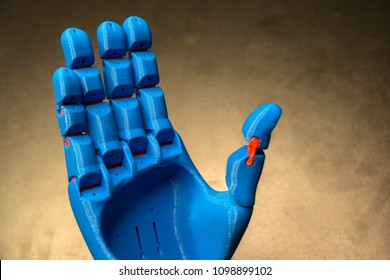 3D Printed Blue Prosthetic Hand