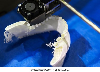 3D Printer. Modern Dental Prosthetics Using Modern Technology. Plastic Mock Jaw On A Blue Background.