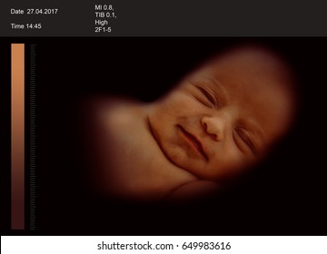 3D ultrasound scan of baby, closeup