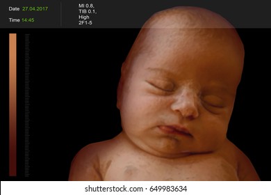 3D Ultrasound Scan Of Baby, Closeup