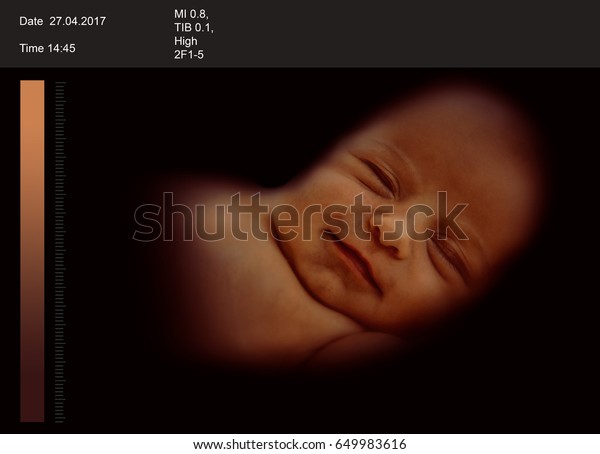 Descubra Examenes De Ultrasonido 3d De Bebe Imagenes De Stock En Hd Y Millones De Otras Fotos Ilustraciones Y Vectores En Stock Libres De Regalias En La Coleccion De Shutterstock Se Agregan Miles De Imagenes Nuevas De Alta Calidad Todos Los Dias