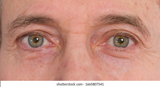 50 Years Old Man Eye Close-up Reference Image