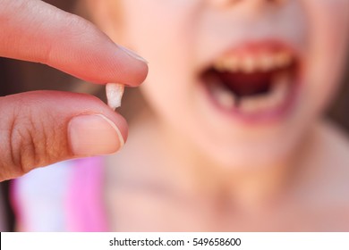 At 6 Years Old Child Has Lost Baby Tooth. 