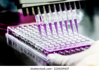 96 well plate for PCR processing, microbiological laboratory. Researcher pipetting samples of liquids in microplate for biomedical research. Scientist working at the biotecnology lab. - Powered by Shutterstock