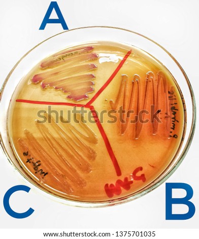 (A) E.aerogenes, (B) P.mirabilis , (C) S.Typhi  On MacCokey agar