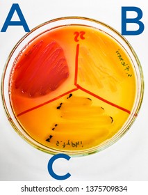 Escherichia Coli On Ss Agar Images Stock Photos Vectors Shutterstock