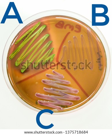  (A) E.coli , (B) S.Typhi , K.pneumoniae On Eosin methylene blue agar  