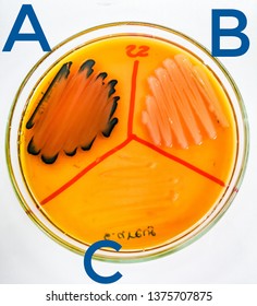 (A) P.mirabilis , (B) S.marcescens , (C) S.aureus On Salmonella-Shigella Agar