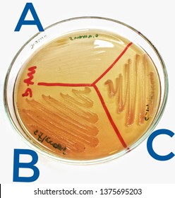 (A) S.aureus, (B) S.flexneri, (C) S.marcescens On MacConkey Agar