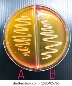 (A) S.aureus (B) S.saprophyticus On Mannitol Salt Agar