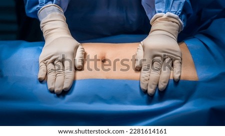 Abdomen prepare for abdominal surgery with sterile drape.Surgeon or nurse in blue uniform put hands with glove on patient.Abdominal surgery inside operating room in hospital.Hernia repair surgery.