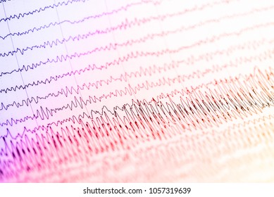 what does an eeg show