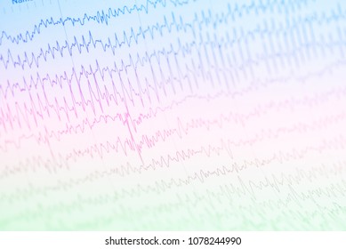 765 Brainwave graph Images, Stock Photos & Vectors | Shutterstock