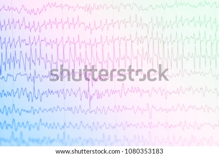 Abnormal EEG waveform, Abnormal EEG, Brainwave on electroencephalogram, EEG wave background, Status epilepticus waveform.