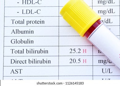 Abnormal High Bilirubin Test Result With Blood Sample Tube