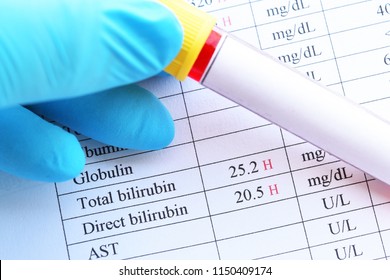 Abnormal High Bilirubin Test Result With Blood Sample Tube